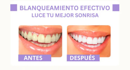 🦷 Blanqueador V34 - Blanco Natural al Instante ⏱️
