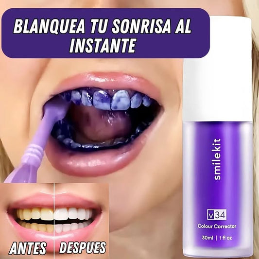 🦷 Blanqueador V34 - Blanco Natural al Instante ⏱️