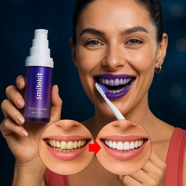 🦷 Blanqueador V34 - Blanco Natural al Instante ⏱️