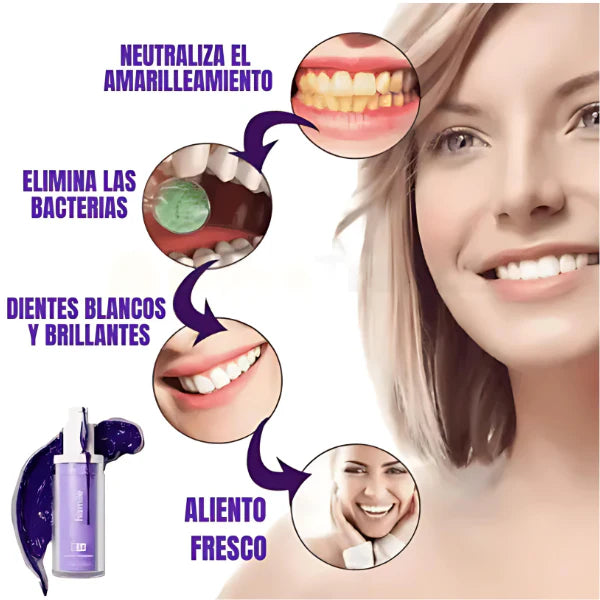 🦷 Blanqueador V34 - Blanco Natural al Instante ⏱️