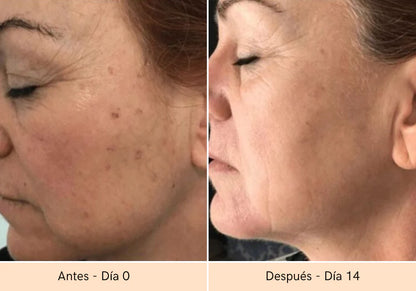 Máscara Rejuvenecedora 7 en 1 AuraMask™ con Fototerapia 🌟